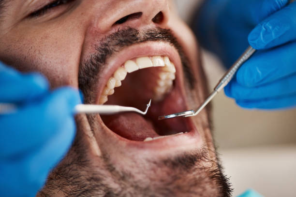 Best Urgent Care for Lost Fillings or Crowns in Vandergrift, PA